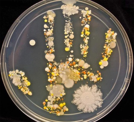 Bacteria-on-the-Handprint-of-an-8-year-old-2-640x581